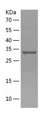    DNA Polymerase beta / Recombinant Human DNA Polymerase beta