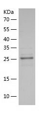    Nucleophosmin / Recombinant Human Nucleophosmin