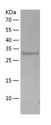    Lactate Dehydrogenase B / Recombinant Human Lactate Dehydrogenase B