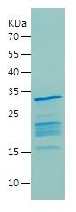    Histone H1 / Recombinant Human Histone H1