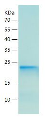    gamma C Crystallin / Recombinant Human gamma C Crystallin