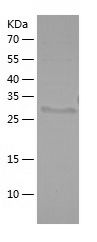    Carbonic Anhydrase 3 / Recombinant Human Carbonic Anhydrase 3