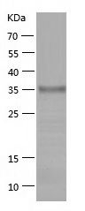    GALT / Recombinant Human GALT