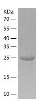    Tropomyosin 2 / Recombinant Human Tropomyosin 2