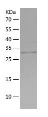    Thrombospondin / Recombinant Human Thrombospondin