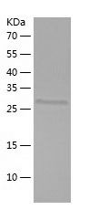 Recombinant Mouse Apolipoprotein E