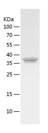    MMP3 / Recombinant Human MMP3