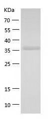    Pyruvate Dehydrogenase E1-alpha subunit / Recombinant Human Pyruvate Dehydrogenase E1-alpha subunit