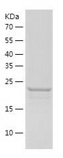    SNRPB2 / Recombinant Human SNRPB2