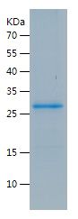    IGFBP1 / Recombinant Human IGFBP1