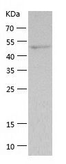    NSE / Recombinant Human NSE