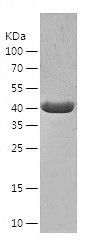    ACAA1 / Recombinant Human ACAA1