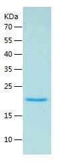 Recombinant Mouse LTA