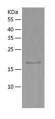    RBP1 / Recombinant Human RBP1