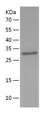    FBP1 / Recombinant Human FBP1