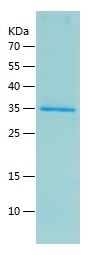    Tropomyosin / Recombinant Human Tropomyosin