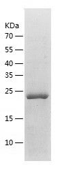    Clathrin light chain B / Recombinant Human Clathrin light chain B