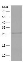    Heme Oxygenase 1 / Recombinant Human Heme Oxygenase 1