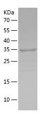    M-CSF / Recombinant Human M-CSF