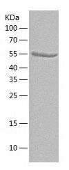    PDGFR beta / Recombinant Human PDGFR beta