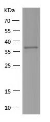    Aldolase C / Recombinant Human Aldolase C