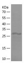    C4b / Recombinant Human C4b