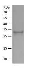    JMJD7 / Recombinant Human JMJD7