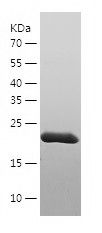    GSTT2 / Recombinant Human GSTT2