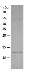    TRAPPC2 / Recombinant Human TRAPPC2