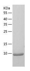    Macrophage Inflammatory1 alpha / Recombinant Human Macrophage Inflammatory1 alpha