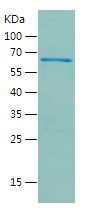    Androgen Receptor / Recombinant Human Androgen Receptor