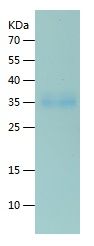    Androgen Receptor / Recombinant Human Androgen Receptor