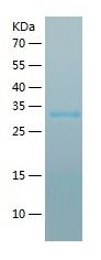    RBP3 / Recombinant Human RBP3