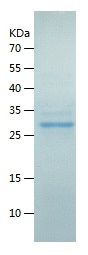    CD11b / Recombinant Human CD11b