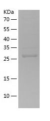    PIM1 / Recombinant Human PIM1