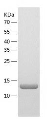    GDX / Recombinant Human GDX