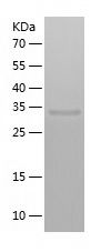 Recombinant Mouse Ornithine Carbamoyltransferase