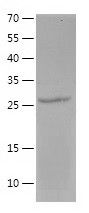    CD20 / Recombinant Human CD20