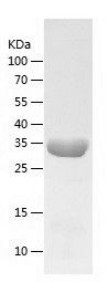    PRPS2 / Recombinant Human PRPS2