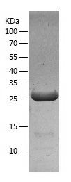    FGF5 / Recombinant Human FGF5