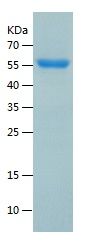    HARS / Recombinant Human HARS