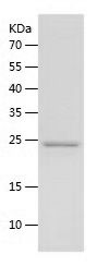    Collagen VI alpha 2 / Recombinant Human Collagen VI alpha 2