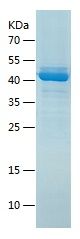    Creatine kinase MT / Recombinant Human Creatine kinase MT