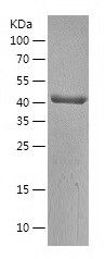    BCKDHA / Recombinant Human BCKDHA