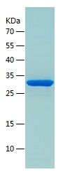    alpha Actinin / Recombinant Human alpha Actinin