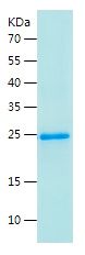    ICAM2 / Recombinant Human ICAM2