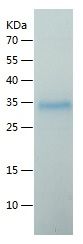    Versican / Recombinant Human Versican