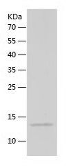    CD59 / Recombinant Human CD59