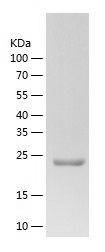    EDN3 / Recombinant Human EDN3