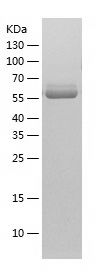    PKM2 / Recombinant Human PKM2